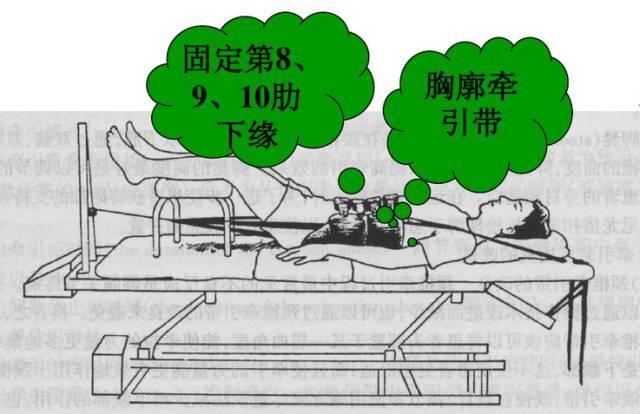 腰间盘突出牵引示范图图片