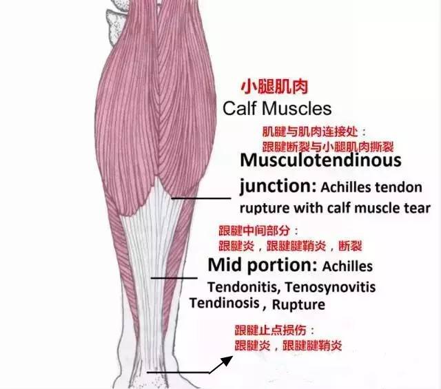 跟腱,明明很强壮,为什么很容易受伤?