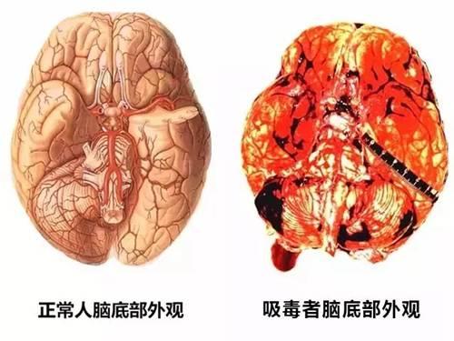 吸食冰毒对神经系统的危害