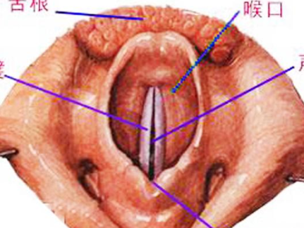 咽炎与正常的咽喉图片图片