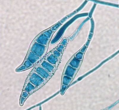 脚气真菌图片显微镜图片