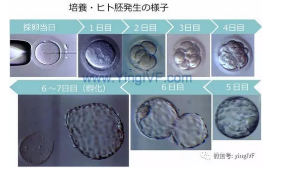 养囊不易五关连闯受精卵培养过程和胚胎级别判定