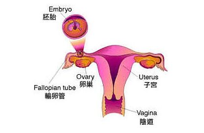 怀孕一个月竟是假胎什么是葡萄胎