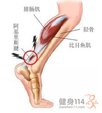 原因:过度训练,速度以及山地练习都可能导致跟腱出现问题