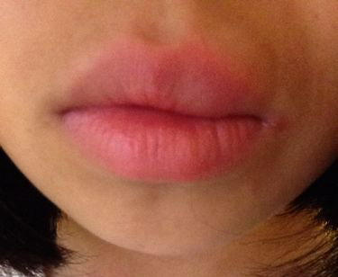 深红色嘴唇出现黑色就要小心了,这可能患了肝病.