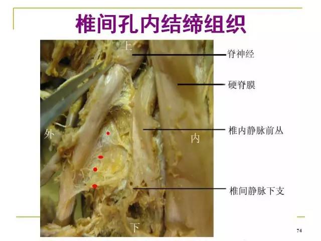 腰椎间孔的解剖与临床