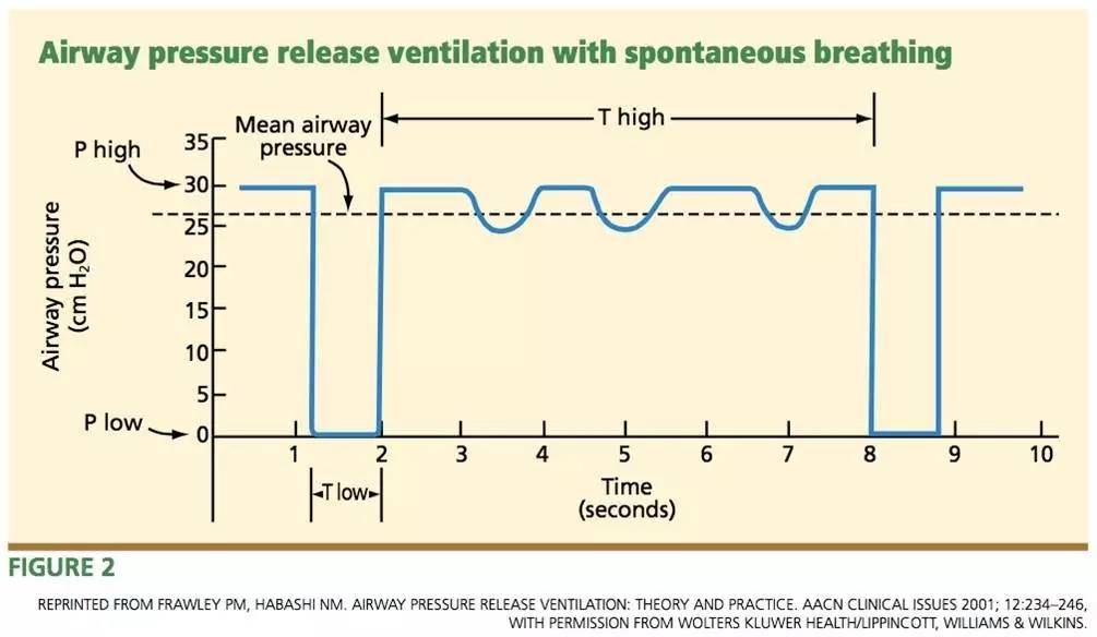 氣道壓力釋放通氣模式——急性呼吸窘迫綜合徵的另一種選擇?