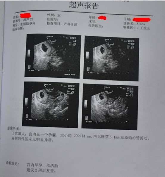 孕8周左右做的b超单,如果发现孕囊椭圆或者是茄子样的,多数是男孩