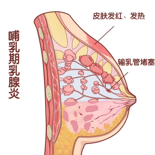 带你一起走进产后乳房的神秘世界