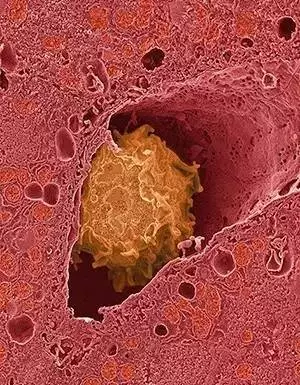 人体内蛲虫的先行军,它是位于肝脏内的巨噬细胞,能够吞噬虫卵和小幼虫