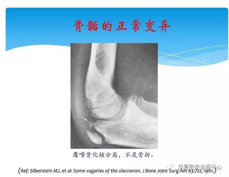 儿童肘关节骨化中心生理及变异