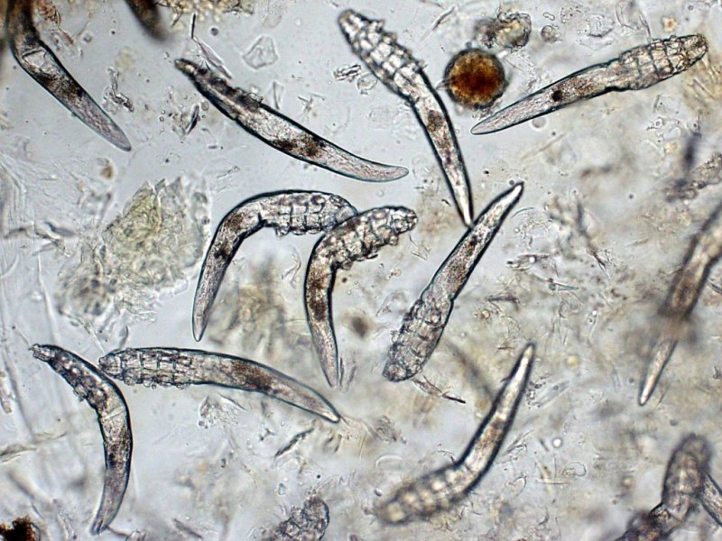 显微镜下的螨虫皮肤图片