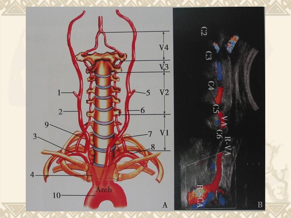 椎动脉5段法解剖图图片
