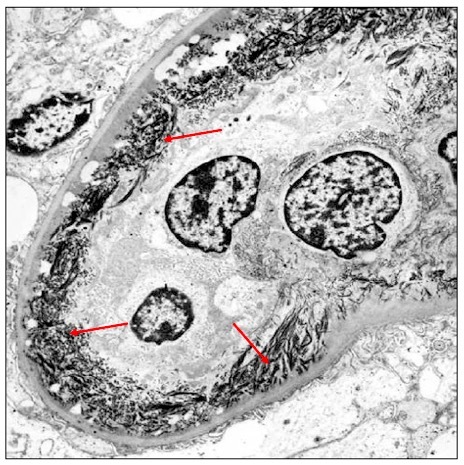 肾细胞显微镜简图图片