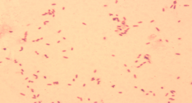沙门氏菌显微图片