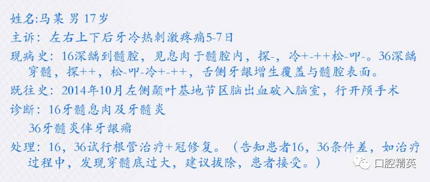 牙龈增生及牙髓息肉伴4根管病例治疗1例