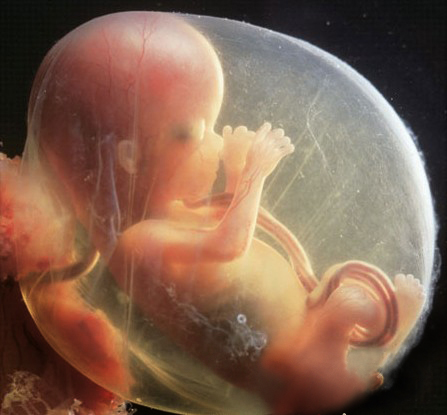 峨眉月胎儿图片