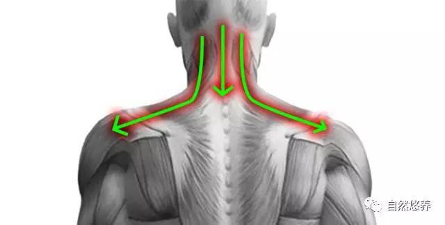 肌肉条索状结节图示图片