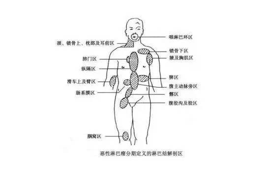 腹部淋巴结位置图图片