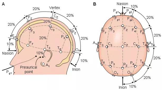 脑电图定位三点五步法图片
