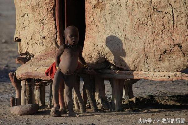 非洲大肚子儿童图片图片
