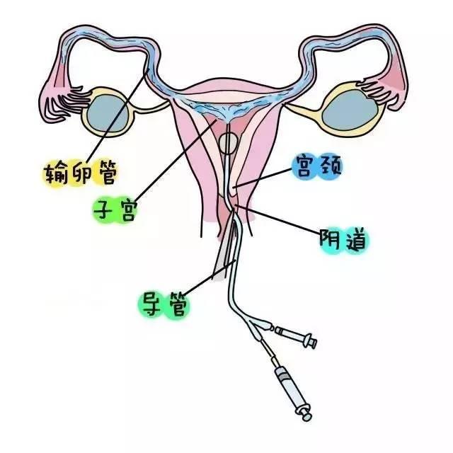 输卵管在左边还是右边图片