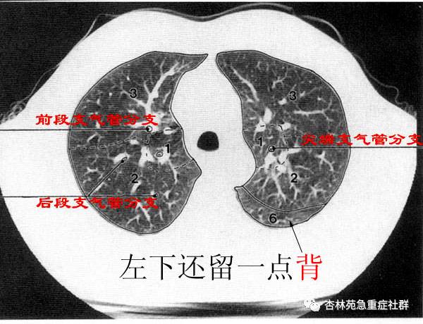 真图实例:各肺段的立体展示:肺是人体的呼吸器官,位于胸腔,左右各一
