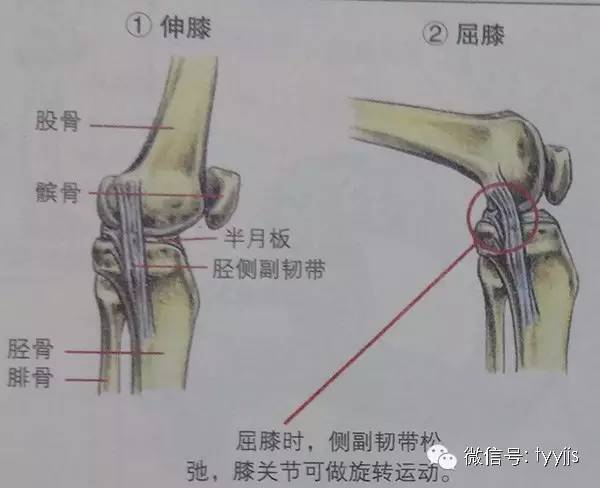 当伸膝时,胫侧和腓侧副韧带紧张,可以限制膝关节旋转.