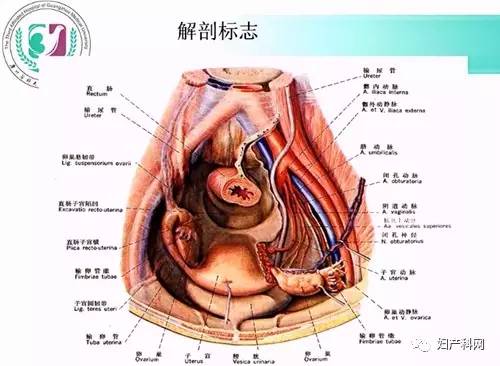 腹腔镜下女性盆腔解剖图片