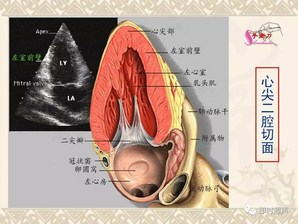 超声心动图怎么做图片