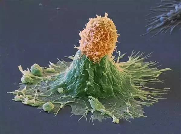 【美图欣赏】免疫细胞与癌细胞搏斗