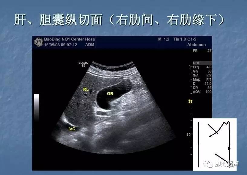 腹部超声检查规范