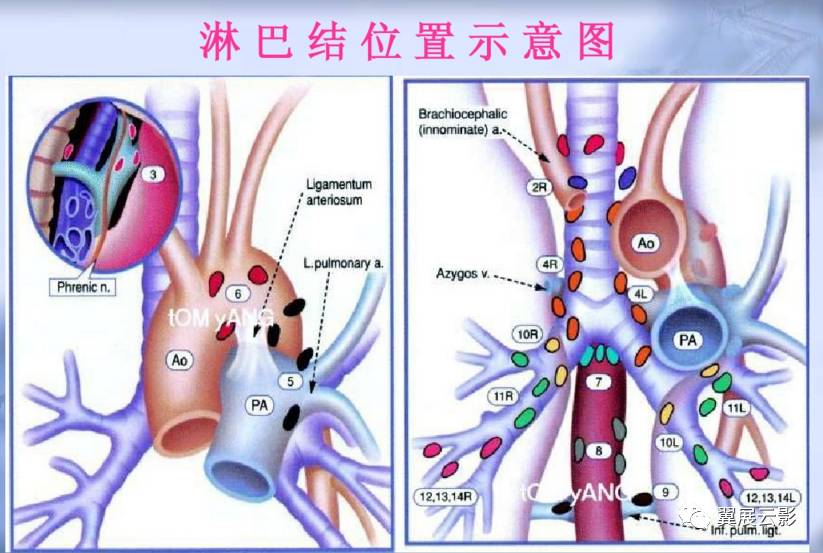 正常胸部ct肺段及淋巴结分区