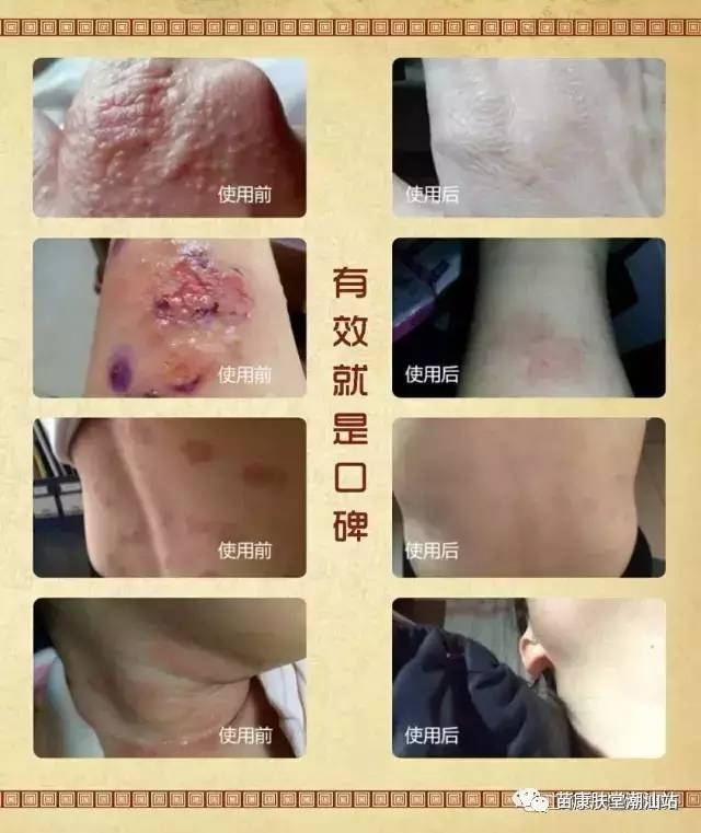 眼睛瘙痒与疼痛：常见原因及应对措施