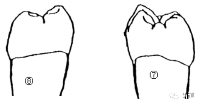 六 下颌第一磨牙和下颌第二磨牙的鉴别