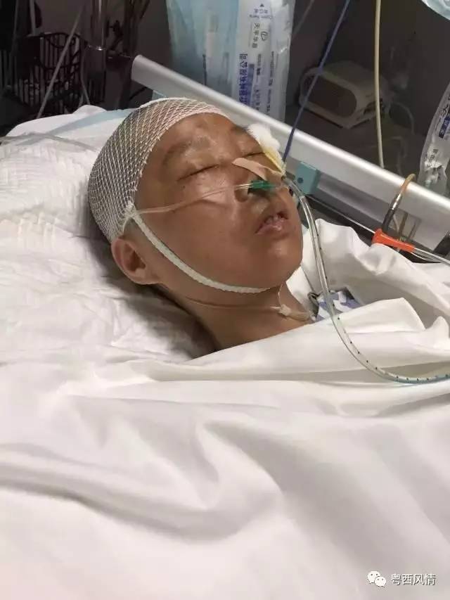 一中年女子因车祸受伤被送入市中医院治疗,该女子为重型颅脑损伤,阳江