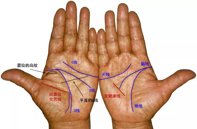 胃癌的饮食调理?饮食禁忌:1,不能抽烟,喝酒2,忌发物和温性食物