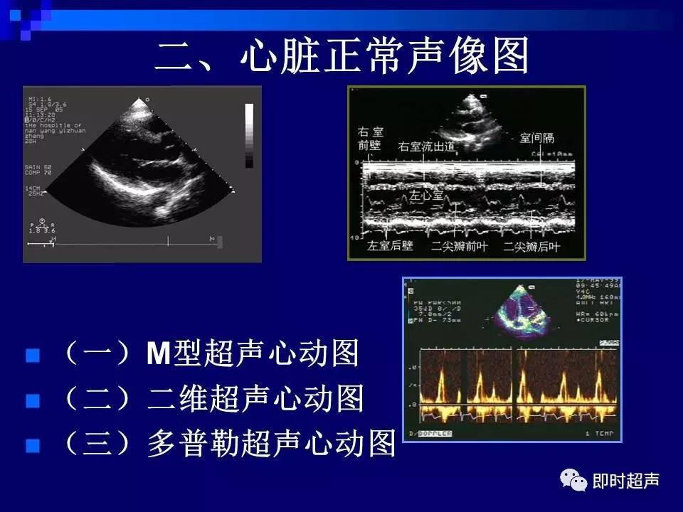 心脏超声解剖及正常声像图