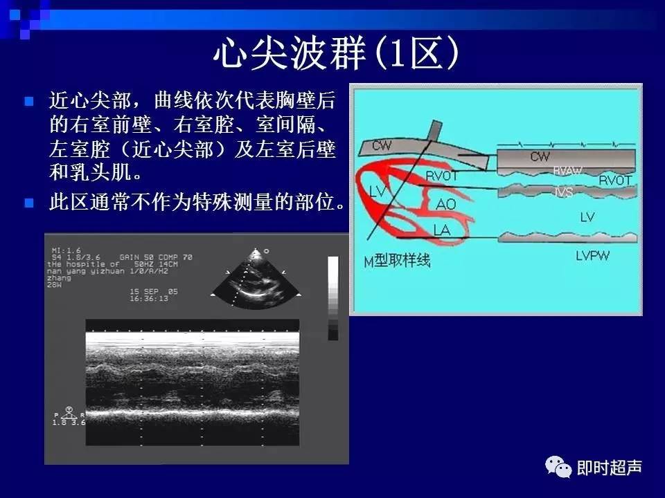 心脏超声解剖及正常声像图