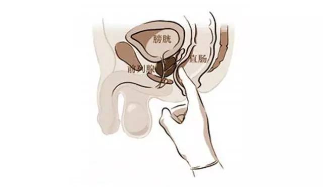 妇科全面检查直肠图片