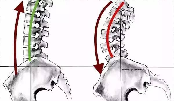 使腰椎曲度加大,進而影響全部脊柱曲度,影響下肢力線,造成背部,肩頸部