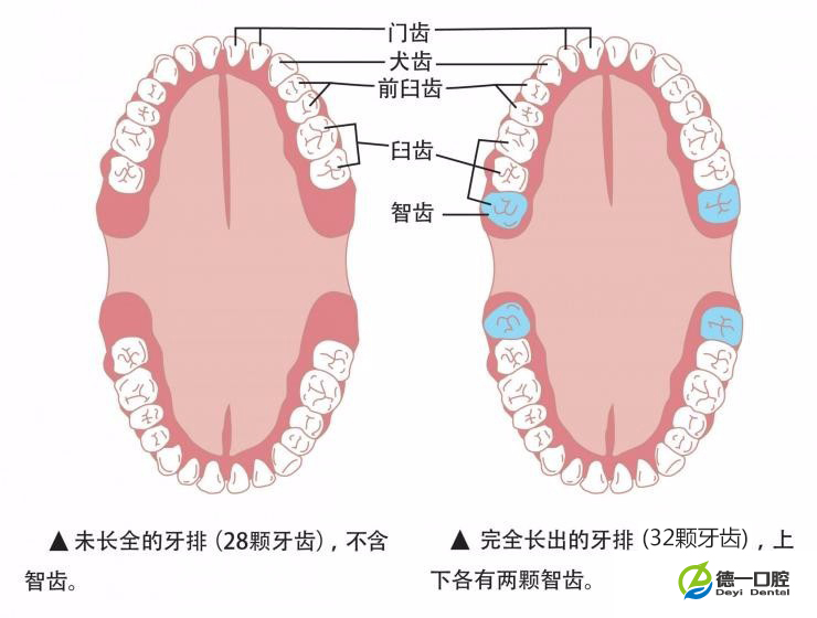 智齿牙龈肿痛怎么办,智齿是拔还是留?