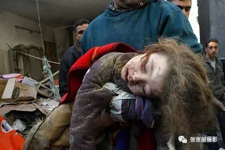 俄乌战争儿童惨烈图片图片