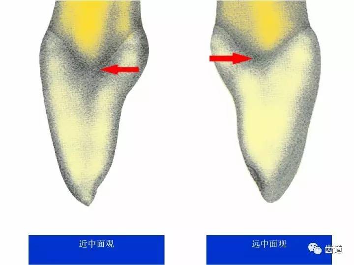 一颗牙的解剖91上颌中切牙解剖形态特征
