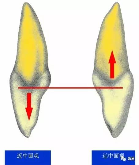 上颌中切牙的轴面图图片