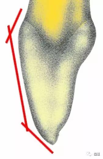 上颌中切牙素描画法图片