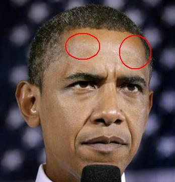 奥巴马↓比如前美国总统奥巴马,额头的额结节凸起,一看就很有智慧的