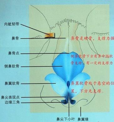 所以呢,我们的开内眼角,就是将这块内眦赘皮通过手术的方式切缝消除