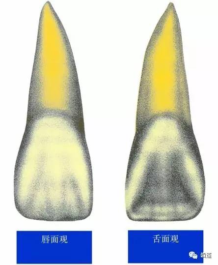 上颌中切牙唇面线图图片