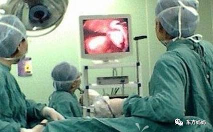 人工流产实拍刮宫术图片